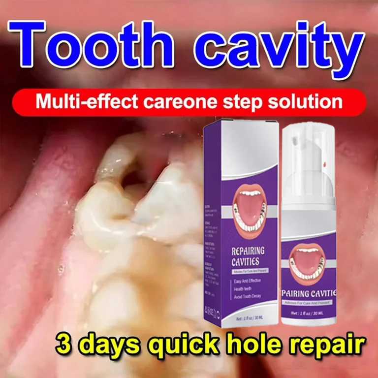 Teeth Whitening Gum - Teeth Cleaning Toothpaste Removes Tooth Stains