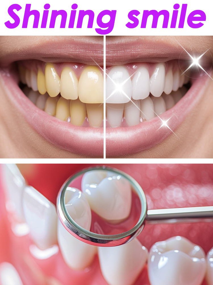 GlorySmile Teeth Whitening Fru - Teeth Whitening Xylitol 评论和价格