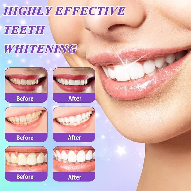 9D Purple Teeth Whitening Toot - Teeth Whitening That Works 评论和价格
