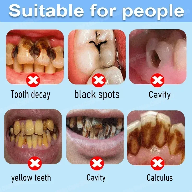 Anti Decay Toothpaste Repairs  - Teeth Whitening That Works 评论和价格