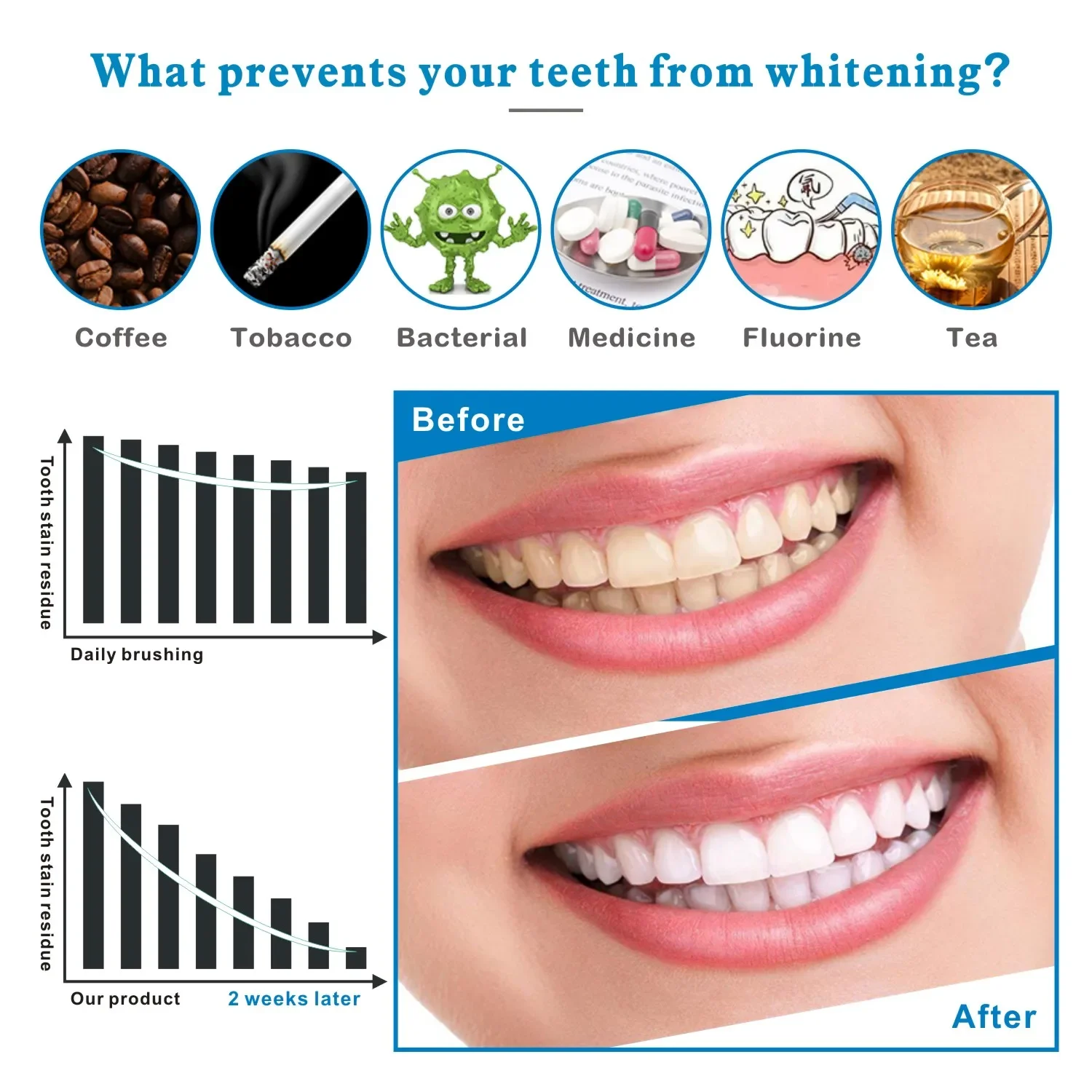 14/28pcs 3D Teeth Whitening St - Teeth Whitening Effects 评论和价格