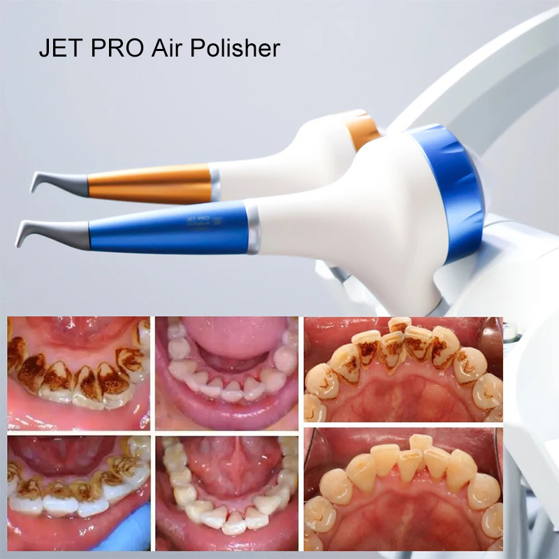 VV Dental  Air Polishing Proph - Teeth Whitening Dental 评论和价格