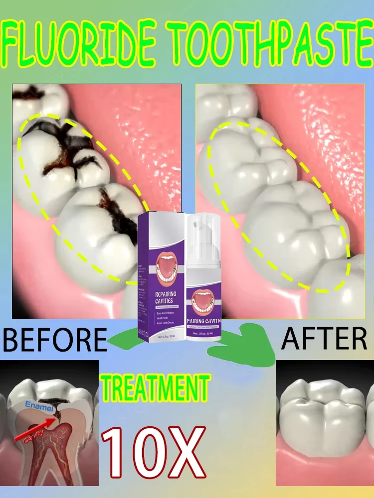 Hot sales Best-selling, Scient - Teeth Whitening That Works 评论和价格