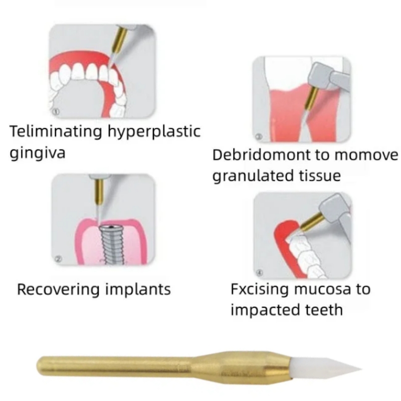 Dental Soft Trimmer Burs Surgi - Teeth Whitening Gum 评论和价格