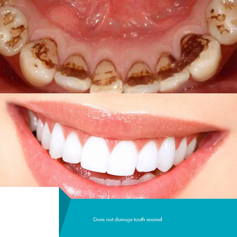 Herbal Tooth Powder, Natural T - Teeth Whitening Xylitol 评论和价格