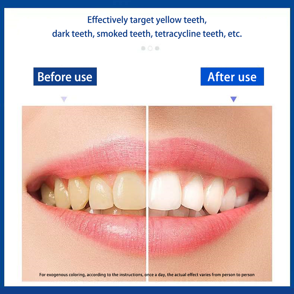 70/140 Pairs 5D White Teeth Wh - Teeth Whitening Effects 评论和价格