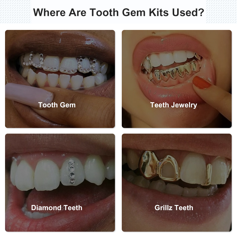 Tooth Gem Set Glue Kit with UV - Uv Whitening Kit 评论和价格