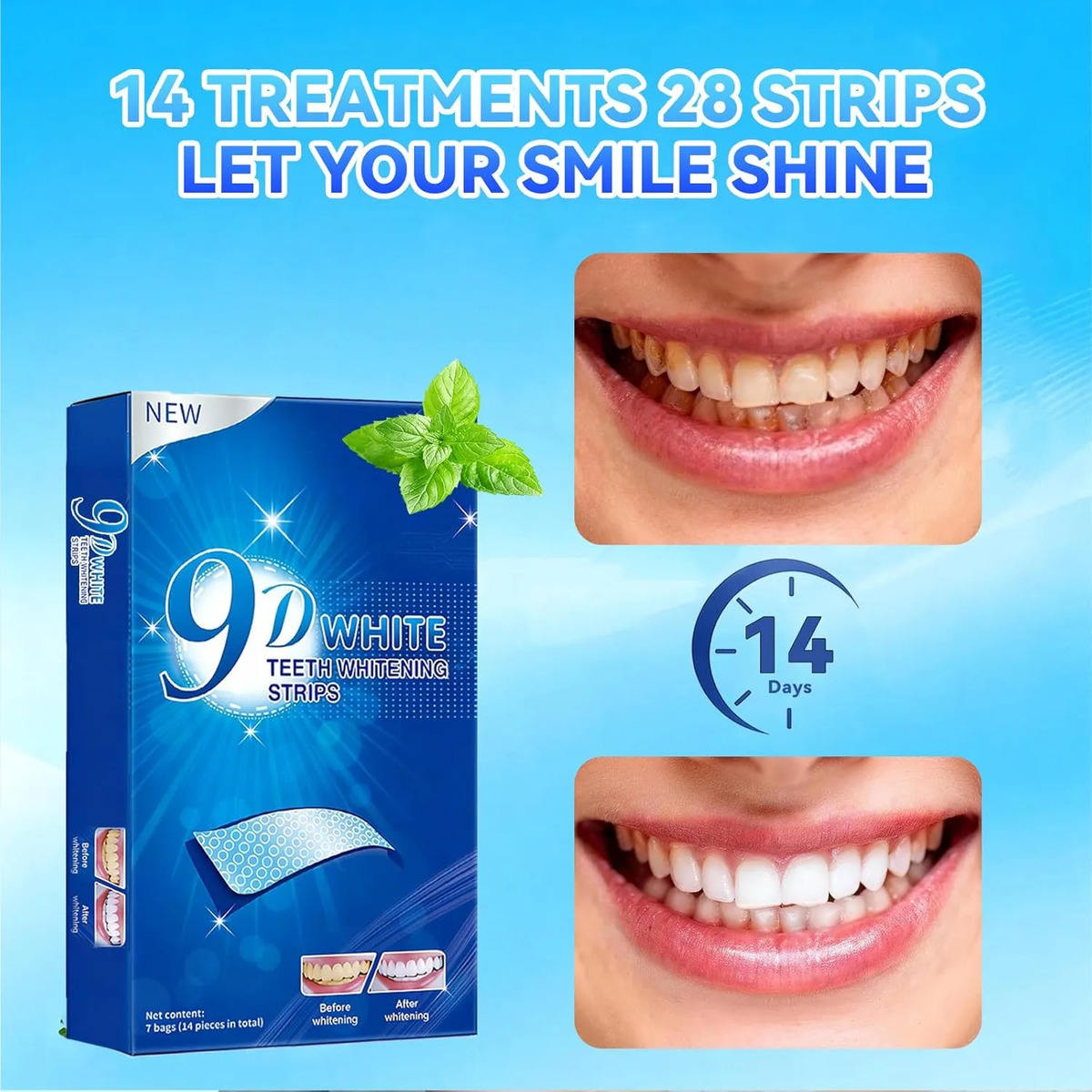 Teeth Whitening Strips - 9D Te - Teeth Whitening Effects 评论和价格