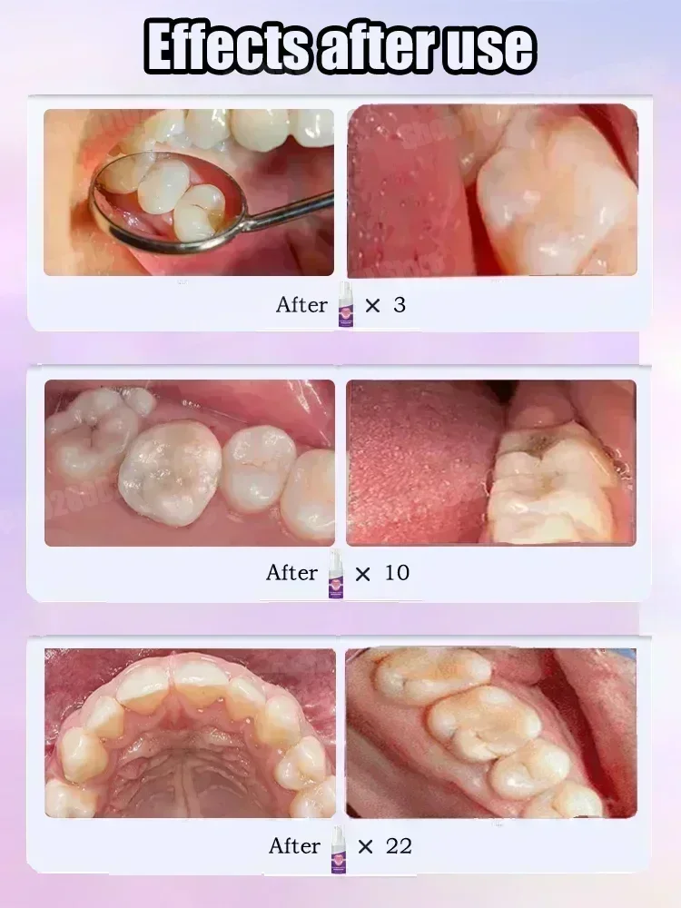 Teeth Cleaning Toothpaste Remo - Teeth Whitening Gum 评论和价格