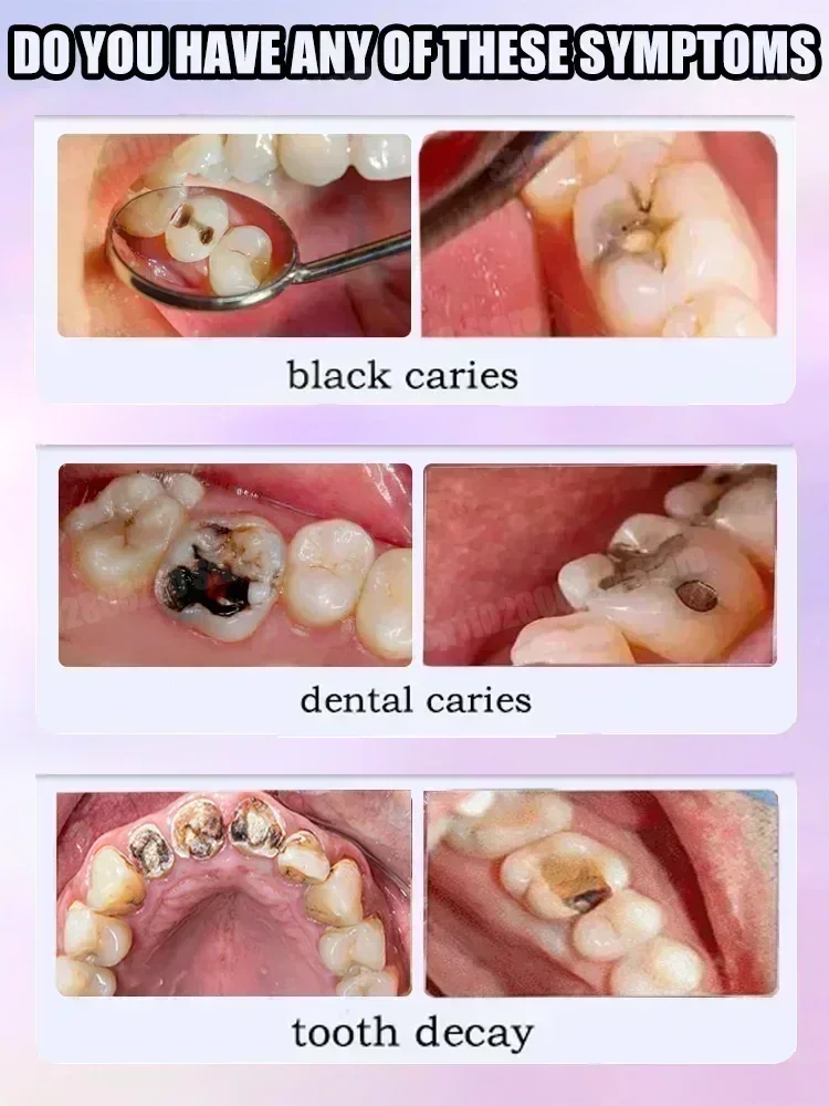 Teeth Cleaning Toothpaste Remo - Teeth Whitening Gum 评论和价格